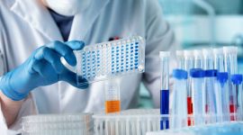 Wissenschaftler mit Handschuhen hält eine Laborplatte mit Proben.